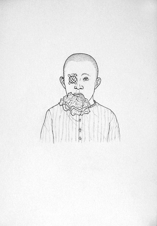 <p><em>one eye bandaged</em>, Kuckei + Kuckei, 2003</p>